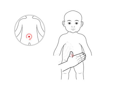 小兒推拿治療感冒嗎？